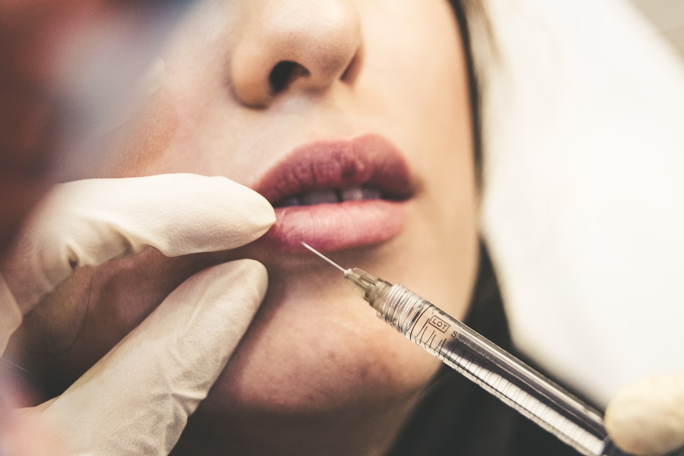 How to Get the Finest Results with Dermal Filler Treatment in San Diego