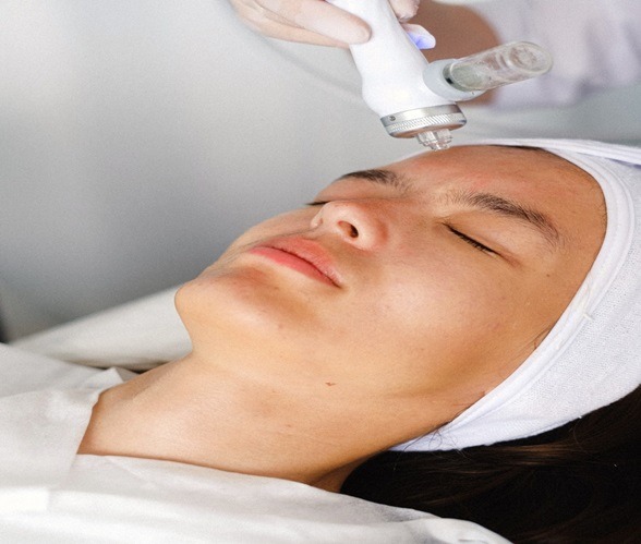 What is Candela Laser Skin Rejuvenation