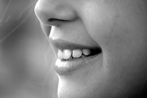 Veneers Make A Beautiful Smile Leaving A Lasting First Impression