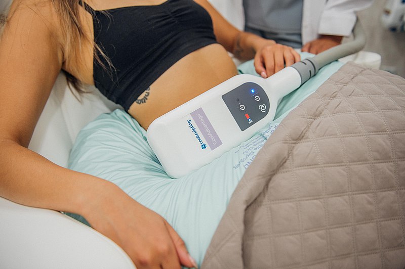 Why is CoolSculpting Gaining Momentum as a Revolutionary Body Sculpting Technique